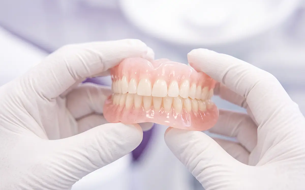 Final fixed full-arch restoration for All-on-4 and All-on-6 treatment